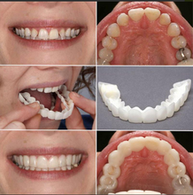 Load image into Gallery viewer, *Limited Supply-THE AMAZING PERFECT SMILE*
