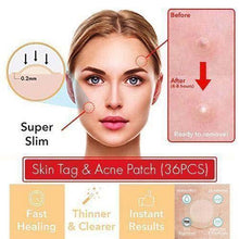 Load image into Gallery viewer, Skin Tag & Acne Patch