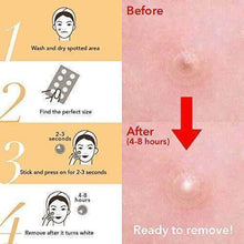 Load image into Gallery viewer, Skin Tag &amp; Acne Patch
